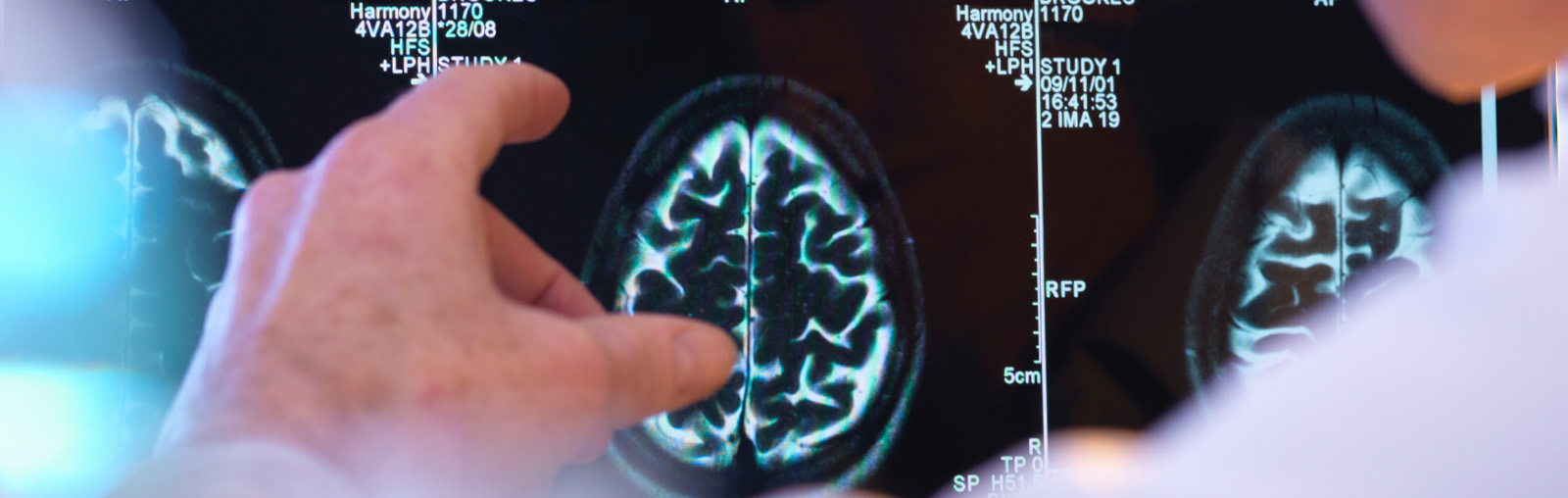 Neurology Neurology treatment in mumbai