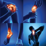Arthroscopic Surgery in Mulund