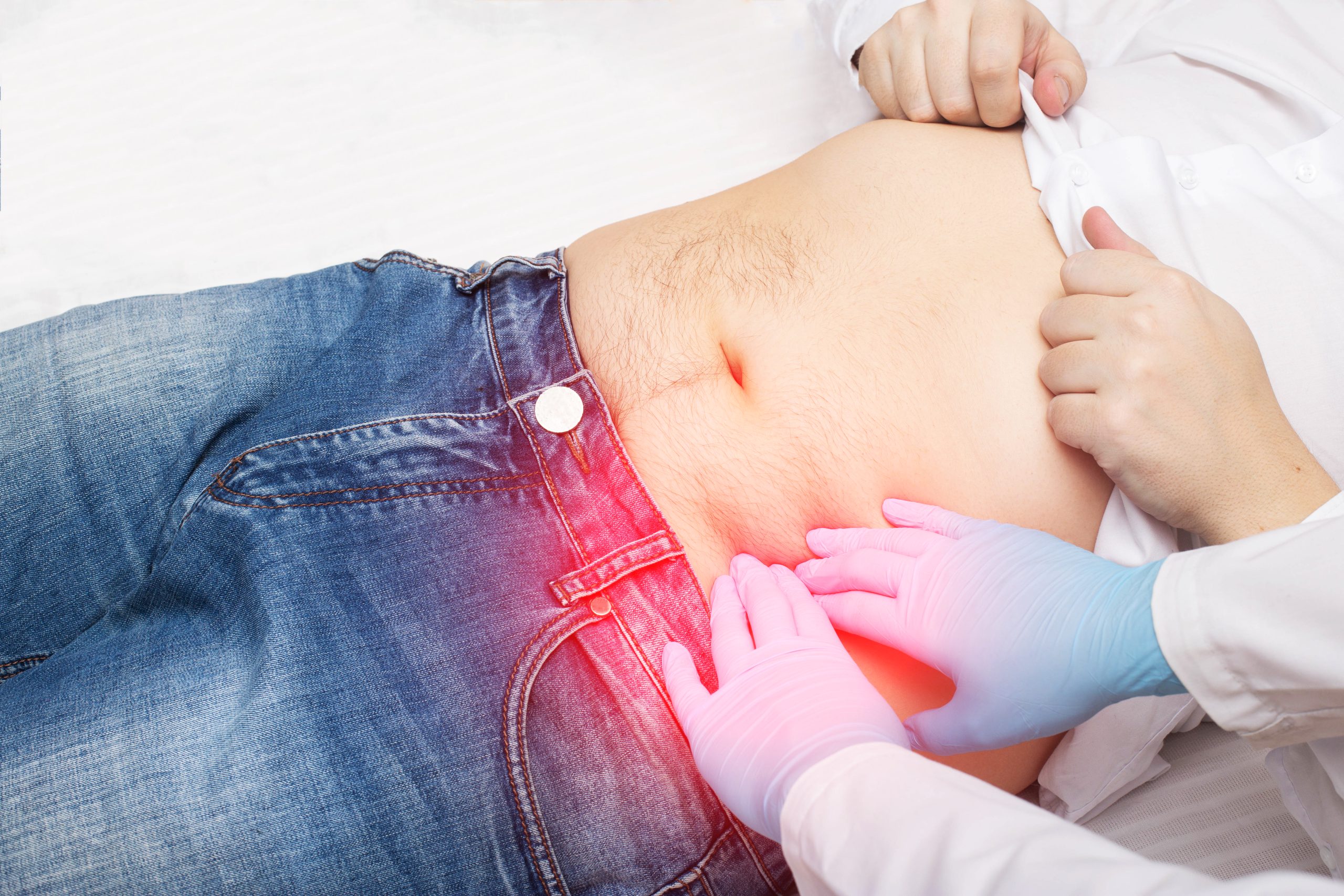 Hernia Treatment