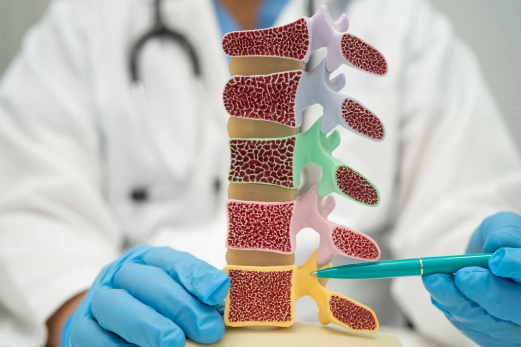Slipped Disc Treatment for Back Pain Relief